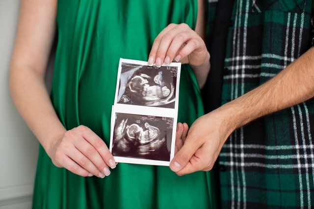 Iemūžini savu gaidību laiku paliekošā foto albumā.